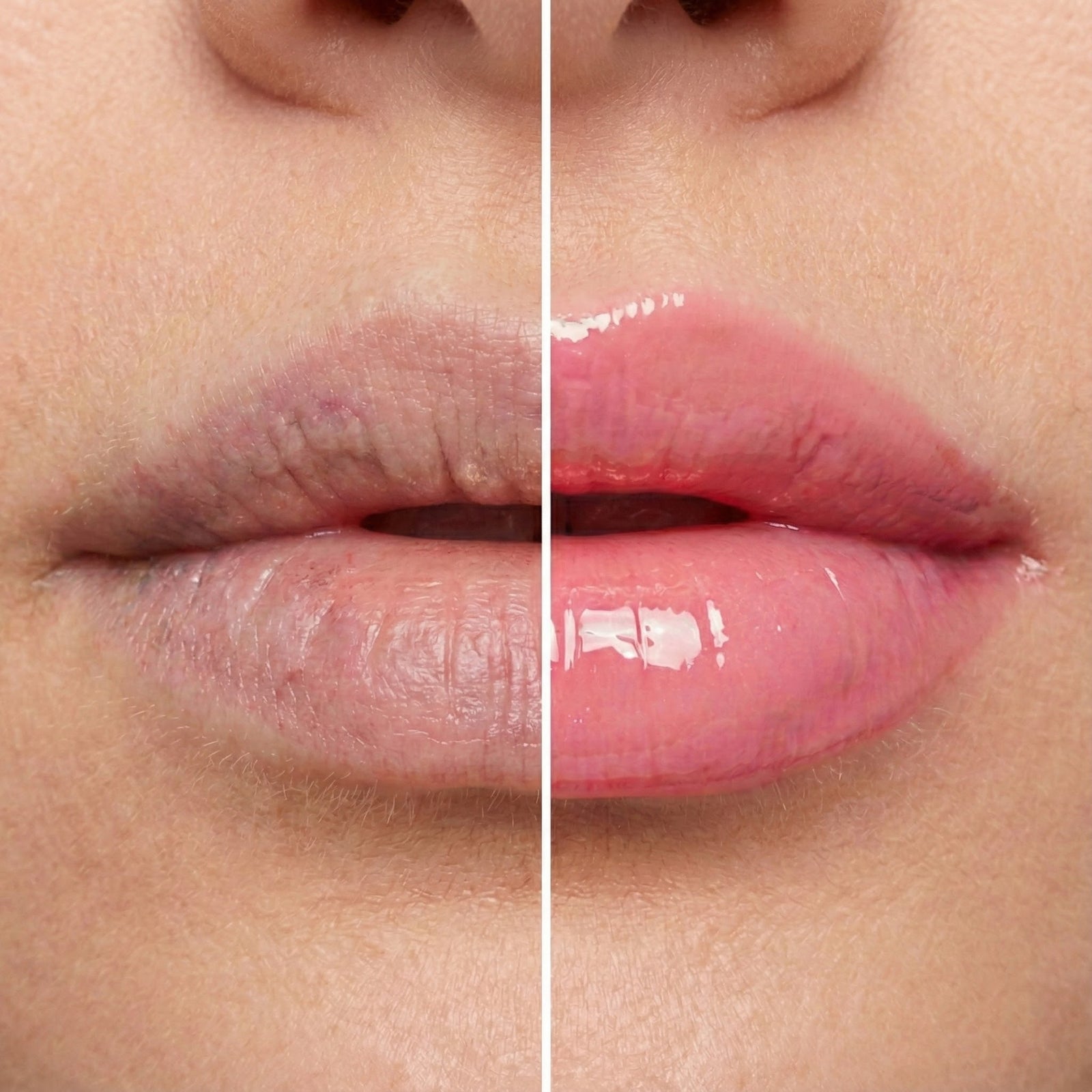 Clinic-grade skin results